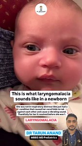19K views · 118 reactions | Laryngomalacia: A Parent’s Guide Does...