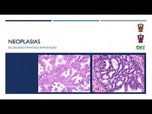 Neoplasias