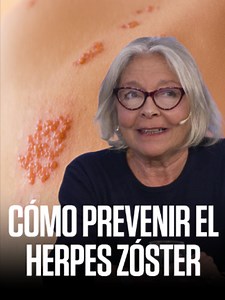 Vacuna herpes zóster: cómo prevenir el herpes zóster
