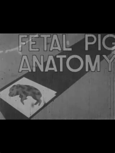 gideonswann (@alienbandsyndrome)’s videos with original soundgideonswann