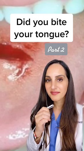 What Happens When You Bite Your Tongue?