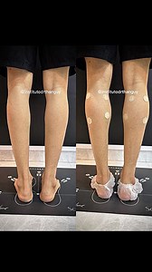 14K views · 40 reactions | After 10+ yrs of training, I think I’m ready for calves implants IG: @Jeff_Fitness | Jeff Ortiz | Facebook