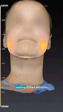 Buccal Fat Removal vs. Buccal Fat Pad Reduction #facialplasticsurgery #plasticsurgery