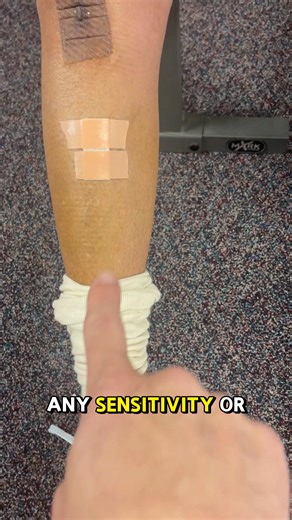 68K views · 268 reactions |  Swelling After Total Knee Replacement –...