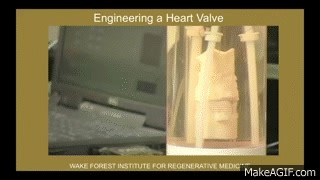 Heart Valve on Make a GIF