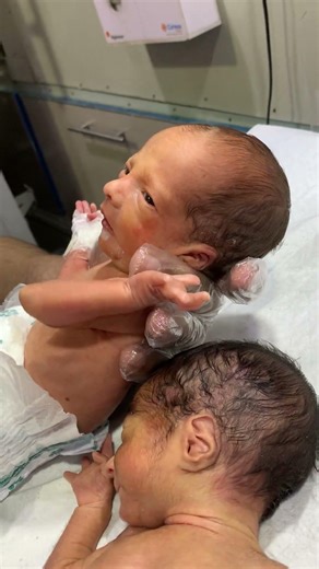 Feeding a Premature Baby with Gentle Care 🤍👶 #premature #baby #shorts