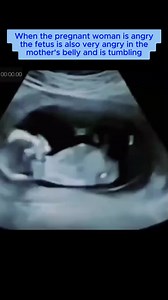 Angry baby in the Womb 😅 | Medical Talks