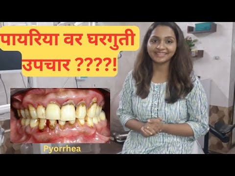 पायोरिया चे कारणे, लक्षणे आणि उपचार | Pyorrhea - Causes, Symptoms and Treatment|