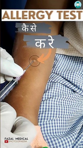 Allergy Skin test procedure| Intradermal Skin test| Skin prick test| Nursing #shortsvideo