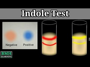 Indole Test | Tryptophanase Test |