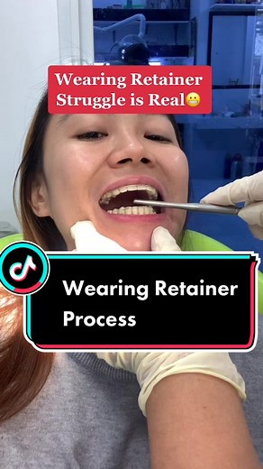Wearing Retainer Struggle: Tips for Cleaning and Maintenance