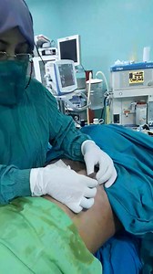 13K views · 164 reactions | Traitement de gynécomastie grade 1 et 2 jeune de 20 ans par liposuccion et chirurgie | Cabinet médico-chirurgical Dr. Youcef Achira Rachida | Facebook