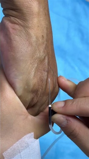 Injection Technique Made Simple | Types of Needle Injections You Need To Know Video 49