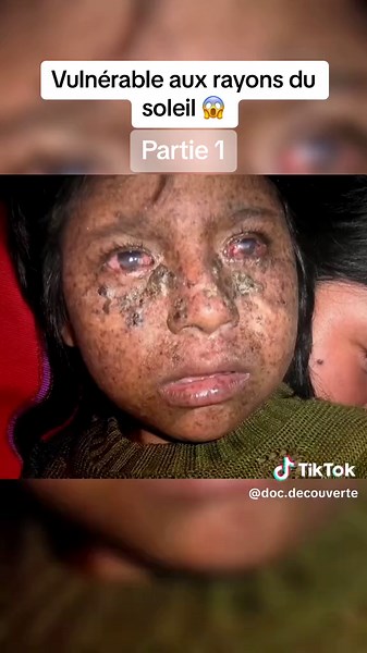 Les Enfants de la Lune : Combat contre la Maladie XP