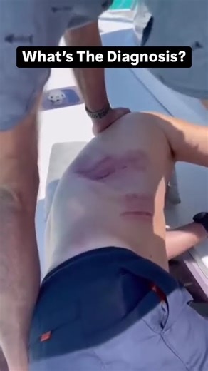 Can you guess the injury??? #doctor #surgeon