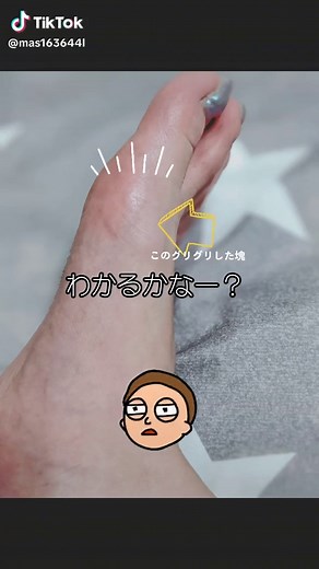 ガングリオンの気になる症状と対処法