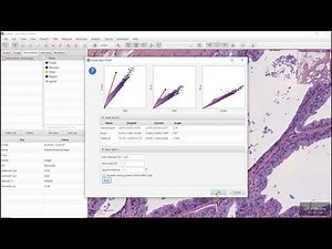 Stain deconvolution with QuPath