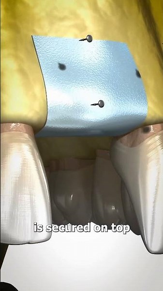 what happens when you loose teeth. #facts #short