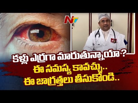 Signs and Symptoms of Conjunctivitis Pink Eye | Virus Conjunctivitis | Allergic Conjunctivitis | Ntv