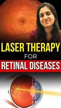 Laser Treatment For Retinal Diseases | Advanced Laser Therapy