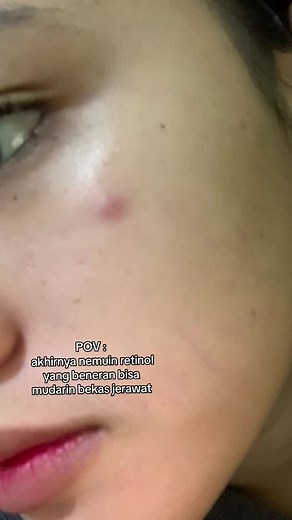 Skincare Routine with The Ordinate Retinol B3 Serum