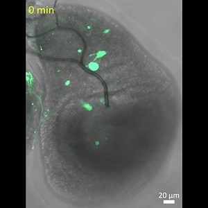 New study from Youfang Zhou, Xianfeng Wang, et al. in the @Denglab_Tulane @tulanemedicine show that induced #polyploidy acts as an intrinsic cellular stress, reprogramming epithelial cells to promote motility and phagocytic behaviors. https://t.co/30pYAgu8Uj