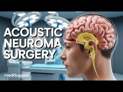 Acoustic Neuroma Surgery Explained 🔍 Is Brain Tumor Removal Really Safe & Effective?