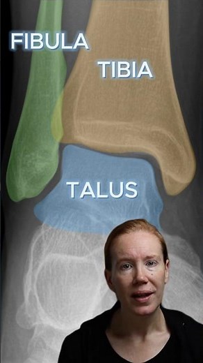 Bevor du Frakturen im OSG Röntgen erkennst, musst du DAS können! #radiologie