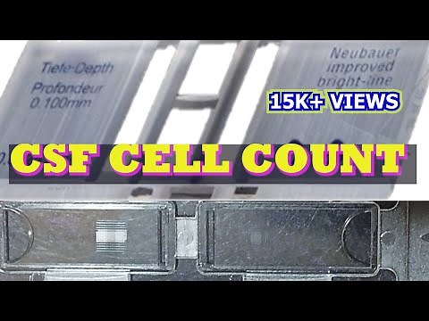 CSF CELL COUNT
