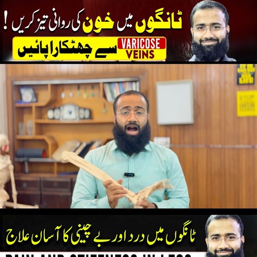 Dr Sulman Feroz | Chiropractor on Instagram: "Fix Varicose Veins Naturally and Strengthen Your Legs #fblifestyle #fixvaricoseveins #naturalhealing #healthylegs #veinhealth #legstrength #WellnessJourney #holistichealth #selfcare #fitnessgoals Tired of visible, painful varicose veins? In this video, you’ll learn 3 powerful exercises to remove varicose veins naturally at home and improve blood circulation fast — no medicine, no surgery needed! These simple leg movements help boost blood flow, stren