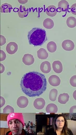 Prolymphocyte Morphological Characteristics