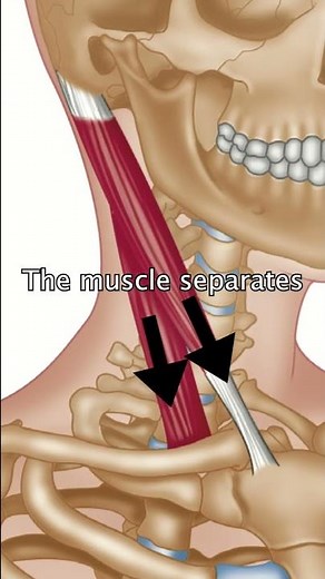 The Sternocleidomastoid Muscle