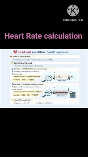 ❤️ Heart Rate Calculation on ECG Simple & Easy Explanation.