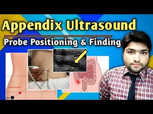 How to do Appendix Ultrasound and Measure Appendix by Dr Ali Waqar