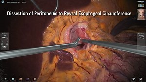 We are proud to lead the simulation market with the most innovative technology breakthroughs. These provide training opportunities of procedures that have never before been available. Here you see the LAP Mentor's Nissen Fundoplication module: https://bit.ly/2TdwgBU #Simbionix #laparoscopy #surgicalsimulation #medicalsimulation #simulation | Surgical Science