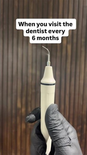 From Cleaning to Extraction 😳 | What Happens If You Skip Dental Visits