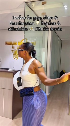 Transform Your Smile with Snap-On Veneers Today