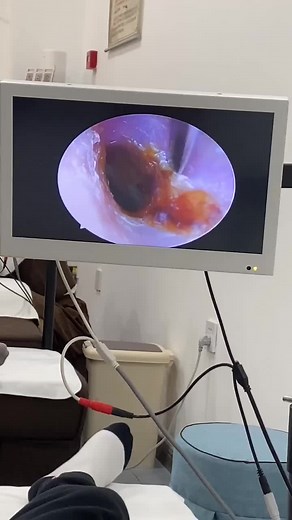 TikTok의 Shinwoo Ear Clinic