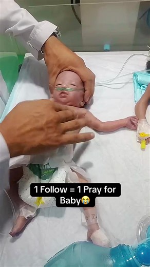 Newborn Baby CPR with Ambu Bag: Essential NICU Skills