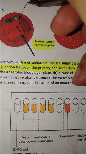 Antibiotic Susceptibility Testing for Sputum (Optochin) Throat swab (Bacitracin) in microbiology lab