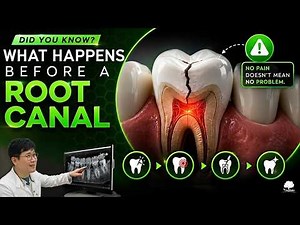 Cracked Tooth = No Pain? Here's Why That's Dangerous 🦷⚠️