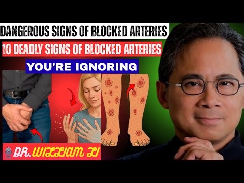 10 Hidden Warning Signs Your Arteries Are Clogged !!!!!!!!!!! – Dr. William Li Explains