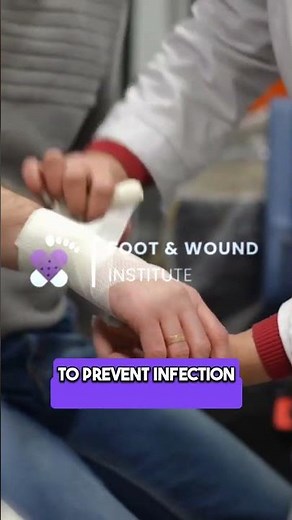 Burn Treatment Basics in 60 Seconds 🔥🧊🩹