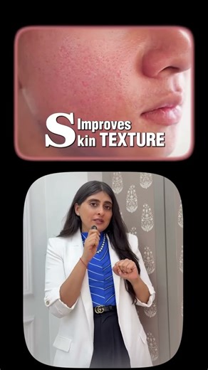 Open Pores Treatment| How to reduce Open Pores| Dermatologist Guide|