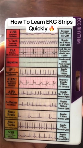 Master EKG Strip Interpretation in Simple Steps