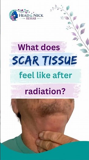 What does scar tissue feel like after radiation?