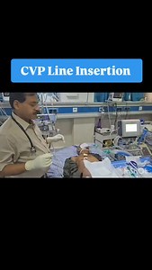 Today, Dr. Abhishek provided a lesson on securing central venous access, a critical procedure for administering medications, fluids, and other therapies directly into a central vein. He began by stressing the importance of a sterile field and carefully cleaning the insertion area with Betadine and spirit, ensuring any potential contaminants were eliminated. This preparation is essential to prevent infection and maintain a safe procedure. Dr. Abhishek then introduced the central line kit, which i