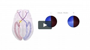 The Optic Pathway & Visual Field Defects by Claire Cooper