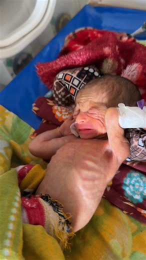 131K views · 12K reactions | Very low birth weight baby #newborn #nicu #lowbirthweight | Medical practice | Facebook