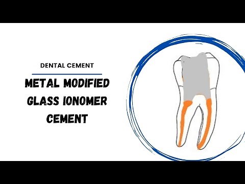 Metal Reinforced Glass Ionomer cement | Dental cermets